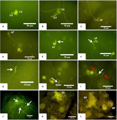 Network Analysis Combining Proteomics and Metabolomics Reveals New Insights Into Early Responses of Eucalyptus grandis During Rust Infection